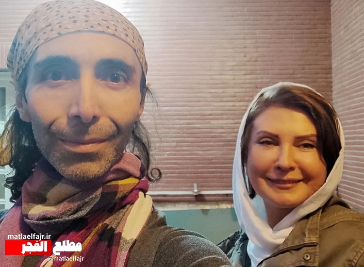 بازیگر زنِ مشهور با این حجم بوتاکس غیرقابل شناسایی شد