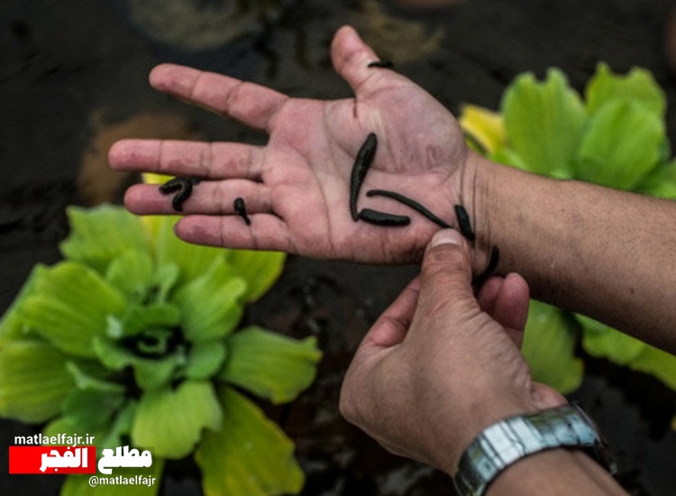 چه کسانی نباید سراغ «زالودرمانی» بروند